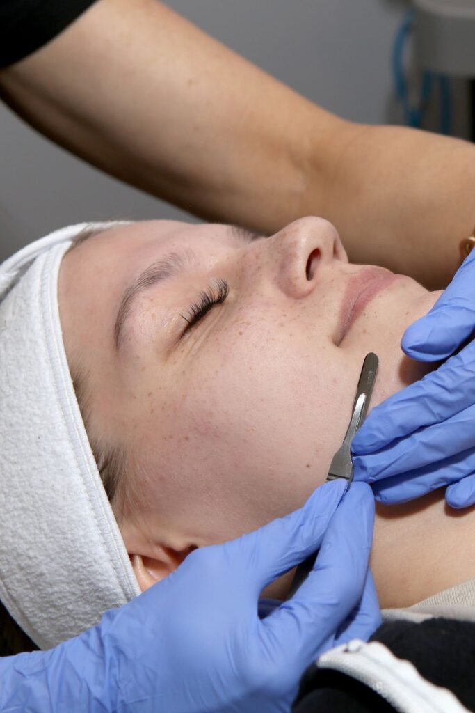 Derma Planing Behndeling