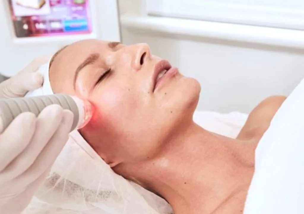 RF huidverzorging (1)