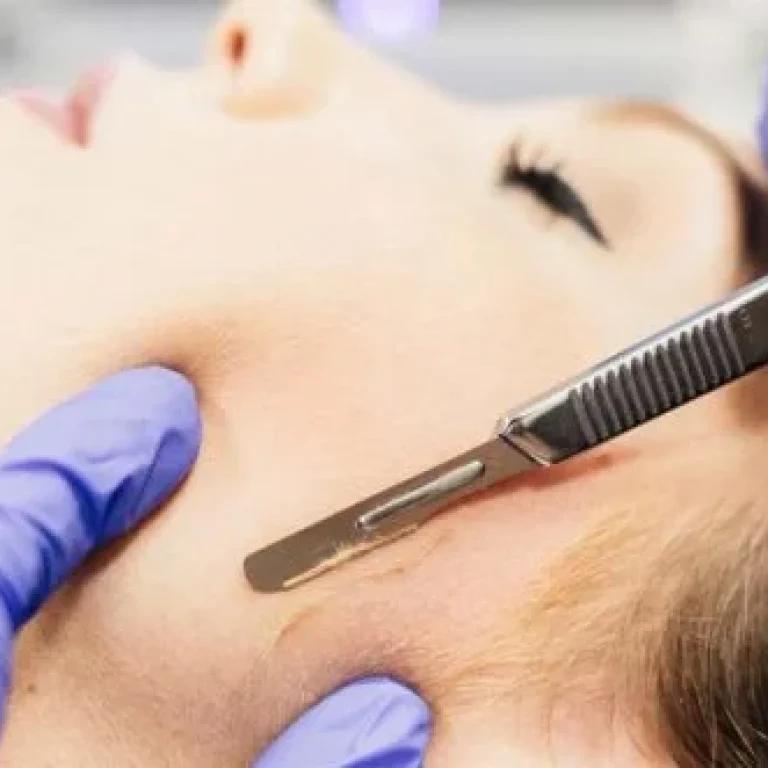 Dermaplaning Amsterdam
