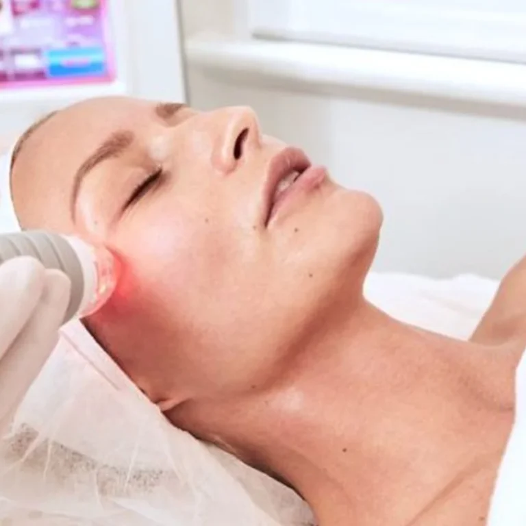 RF huidverzorging (1)